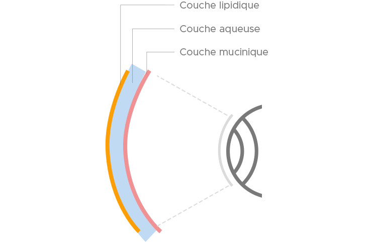 Understanding Causes